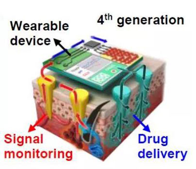 第四代透皮给药技术：在可穿戴设备的帮助下，用于患者定制治疗.jpg